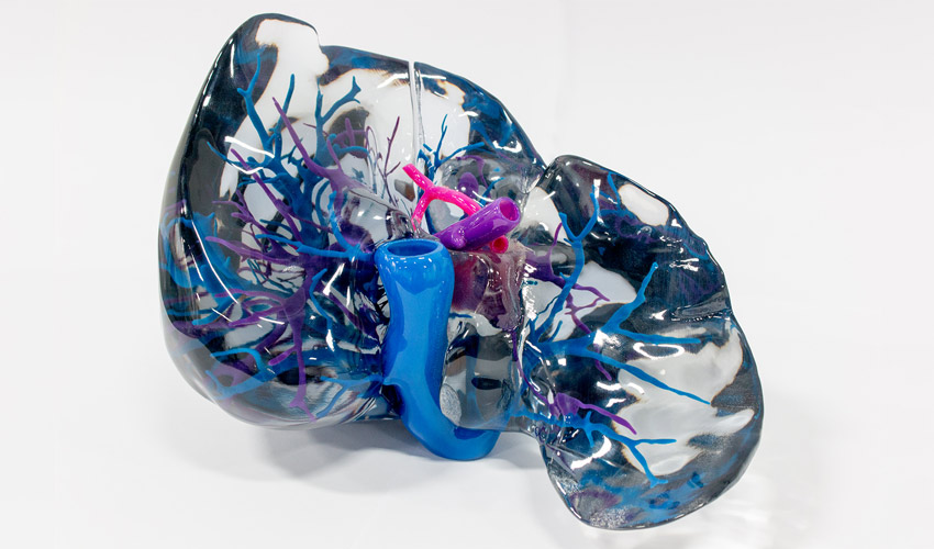 impression 3D par jet de matière